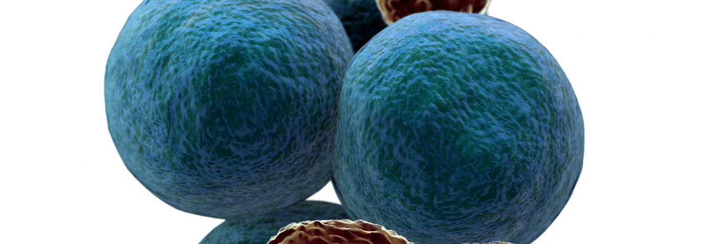New Trial for Celyad’s CAR T-cell Therapy in Ovarian, Other Cancers to Start in Belgium