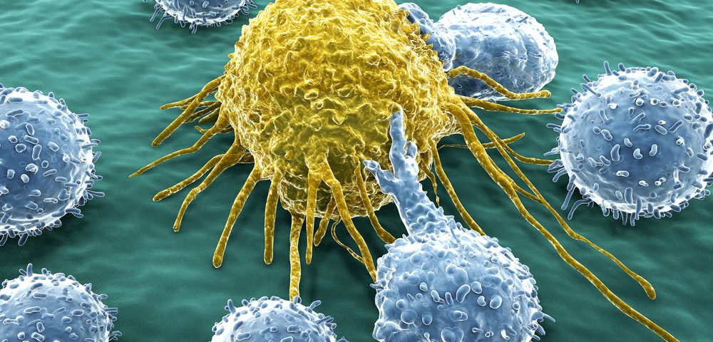 Higher Levels of Tumor T-cells Predict Better Survival Rates in Certain Ovarian Cancer Patients, Study Finds
