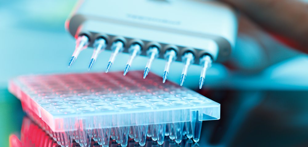 Parsortix-based Blood Test Out-performs CA125 in Detecting Ovarian Cancer, Studies Show