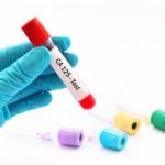 CA-125 blood test study