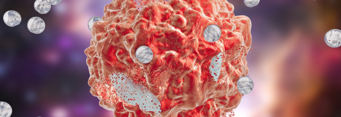 Nami Developing Targeted Nanoparticle Therapy for Advanced Forms of Ovarian Cancer