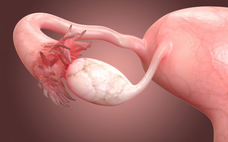 fallopian tube cells, ovarian cancer